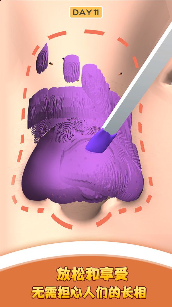 我愛擠黑頭游戲最新版