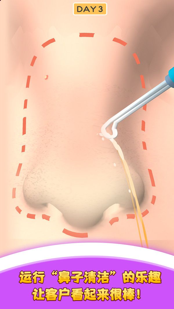 我愛擠黑頭游戲最新版