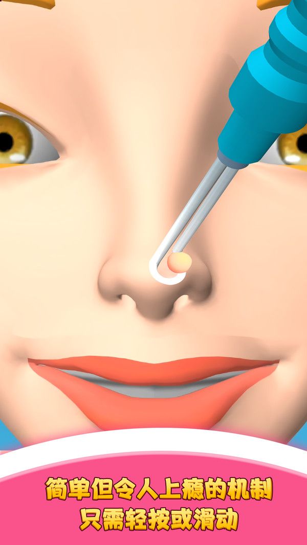 我愛擠黑頭游戲最新版